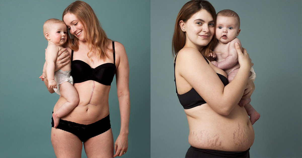 10 женщин, которые не стесняются показывать свое тело после родов