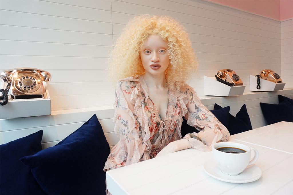 Через тернии к звездам: как странная рыжая девочка-альбинос из Африки стала востребованной моделью в Канаде