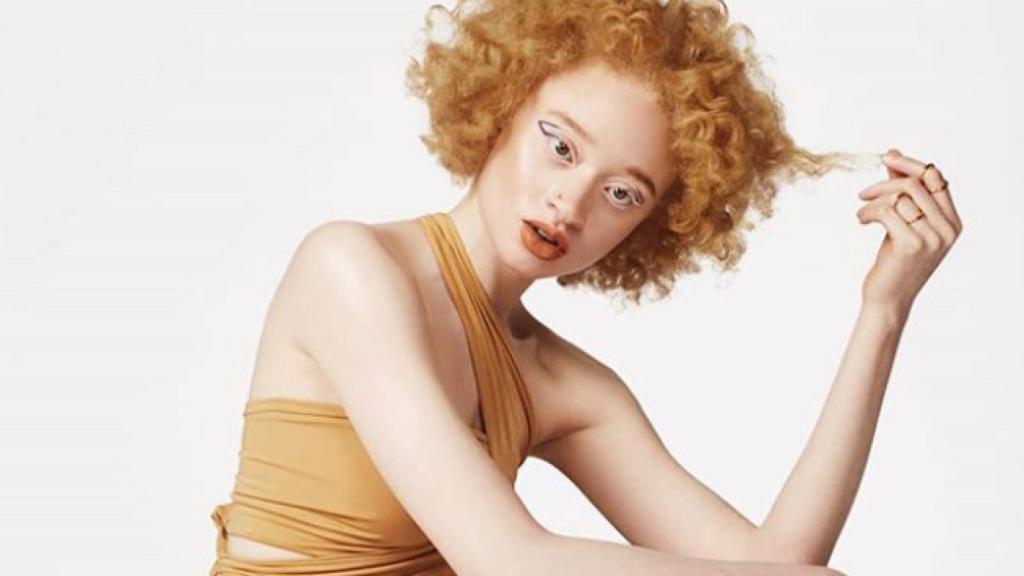 Через тернии к звездам: как странная рыжая девочка-альбинос из Африки стала востребованной моделью в Канаде