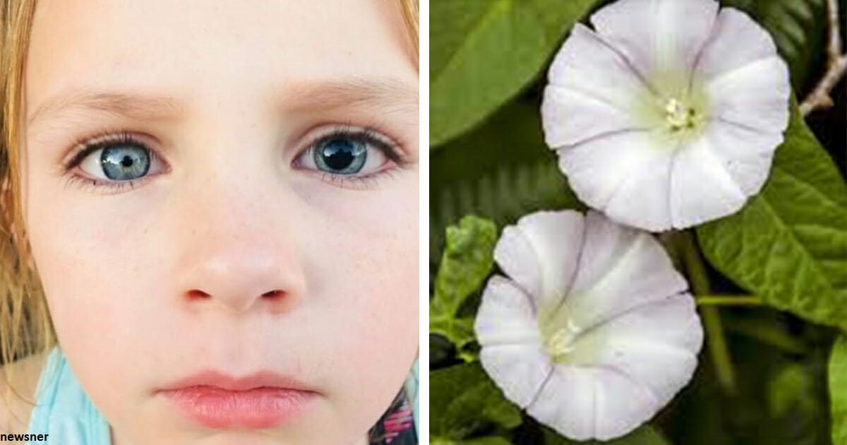 Девочка испортила себе глаз во время игры с этим цветком: не подпускайте к нему детей!