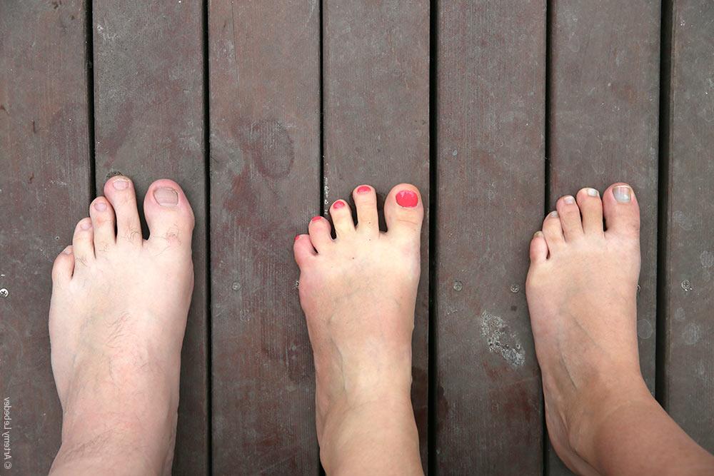 Указательный палец на ноге длиннее большого: это не просто дефект. О чем говорит такая особенность