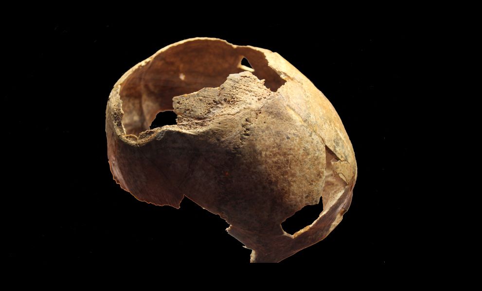 Древний череп, найденный в Крыму, впечатлил ученых следами прижизненной трепанации