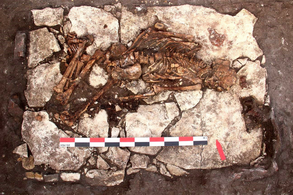 Древний череп, найденный в Крыму, впечатлил ученых следами прижизненной трепанации
