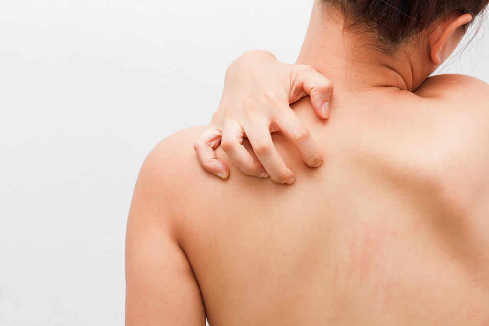 Герпес на спине: причины появления, признаки и эффективное лечение