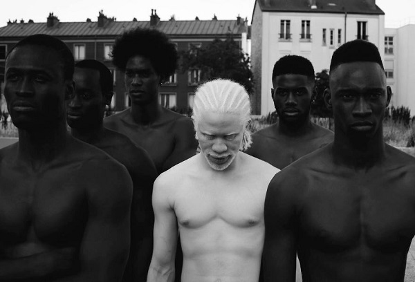 Этот нежный фотопроект об удивительных альбиносах заставит тебя по другому взглянуть на «особенных». 