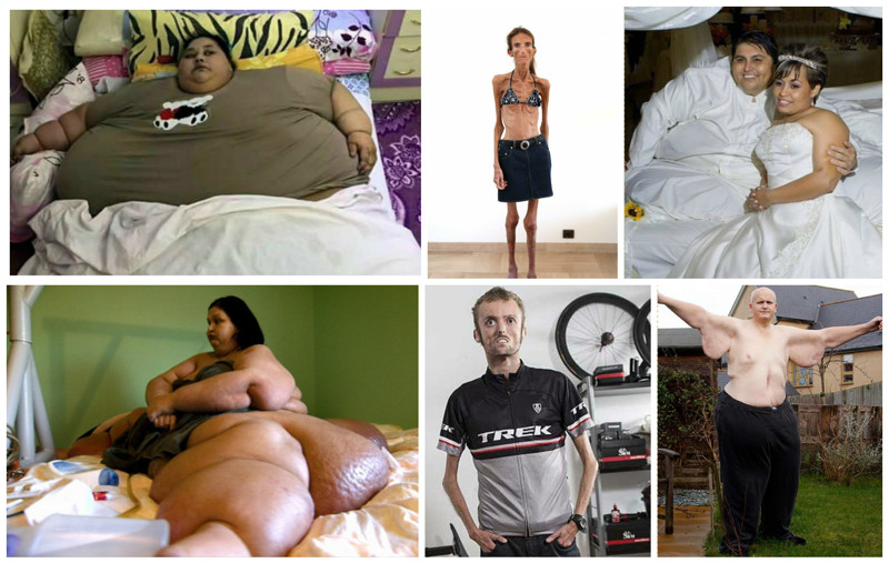 Самые толстые и самые худые люди мира