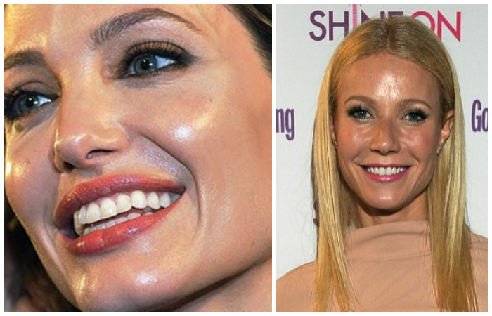 Результат на лицо: 10 правил ухода за жирной кожей, которые быстро порадуют отражением в зеркале