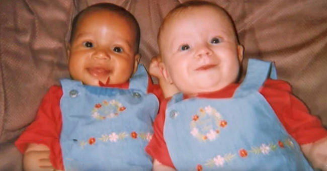 Эти близняшки родились с разным цветом кожи. Вот как они выглядят 18 лет спустя